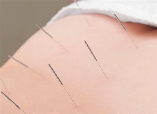 河北省郭氏按摩職業(yè)培訓(xùn)學(xué)校中醫(yī)針灸推拿專(zhuān)業(yè)培訓(xùn)班開(kāi)課了嗎？