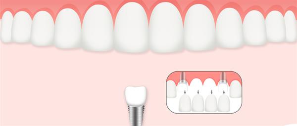 濟南口腔醫(yī)學專業(yè)學校是什么層次的學校？學校怎么樣？