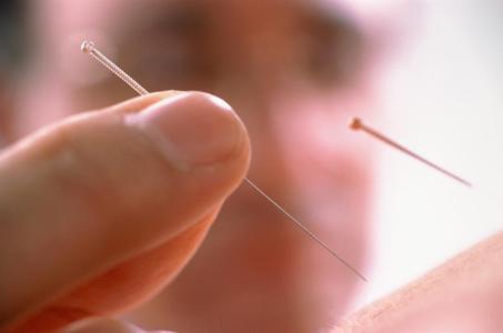 石家莊炎黃針灸推拿學(xué)校：針灸推拿有哪些好處？